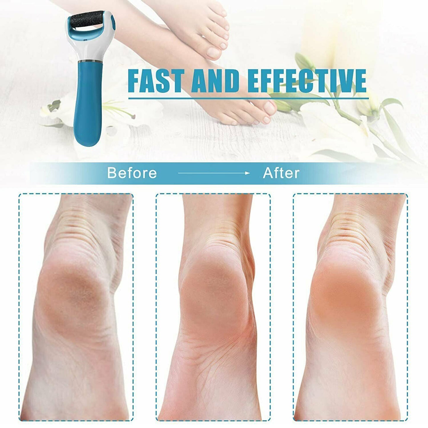 Electronic Dry Foot File Callous Remover For Feet Electric Foot With Roller Hard And Dead Skin- Regular Coarse Baby Smooth Feet In Minutes. For In Home Padicure Foot Care Battery Powered  Usb (Battry Not Included)